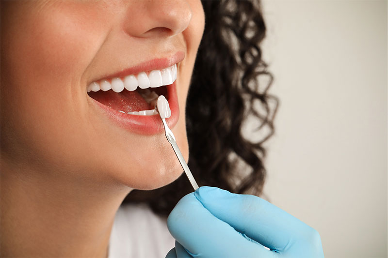 Quality Dental Treatments in Las Vegas