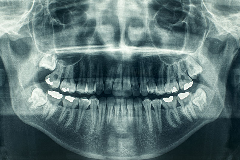 Cone Beam CT Imaging in Bastrop