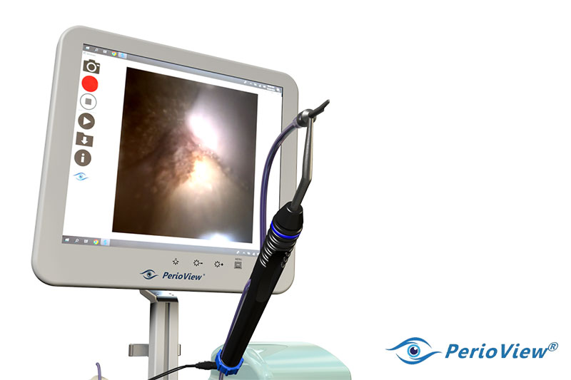 Cone Beam CT Imaging in Kennewick