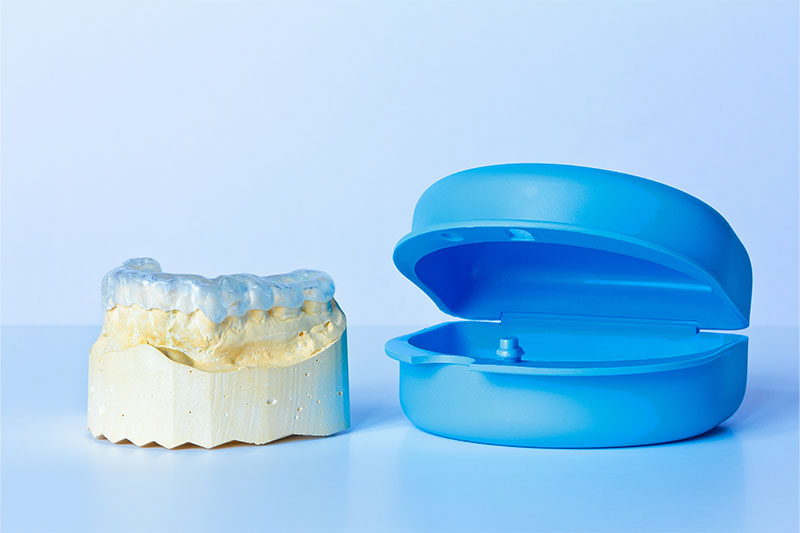 Occlusal Mouthguard in Prosper