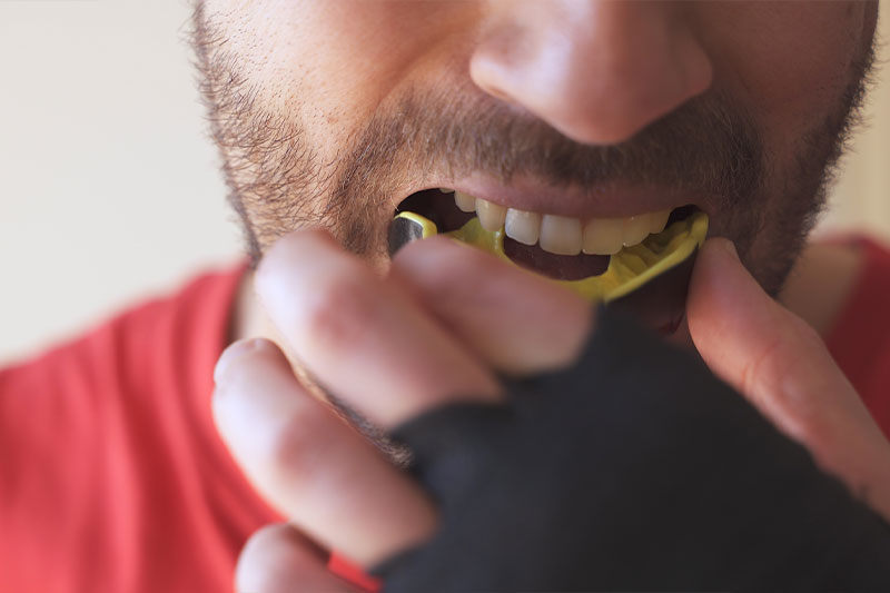 Sports Mouthguard in Prosper