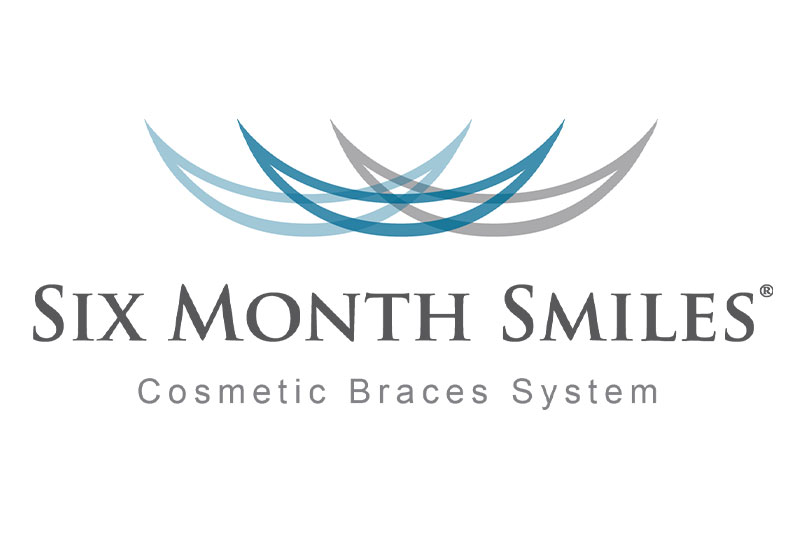 Six Month Smiles Clear Aligners in Milford