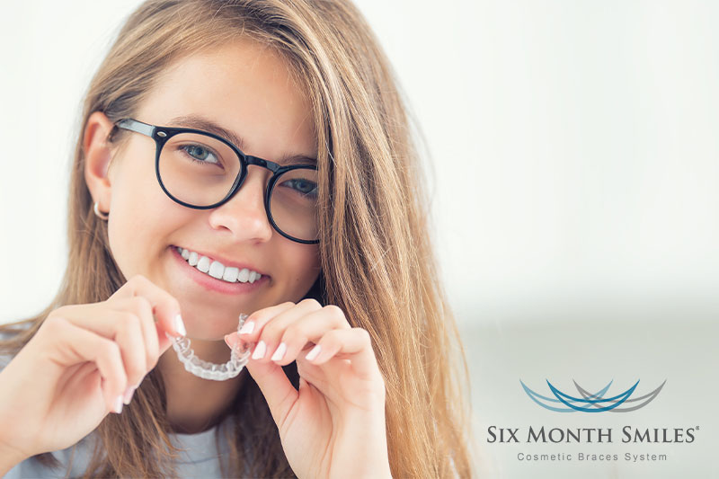 Six Month Smiles Clear Aligners in Milford