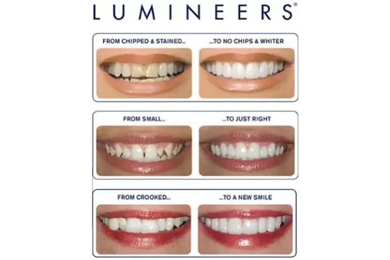 Lumineers in Trumbull