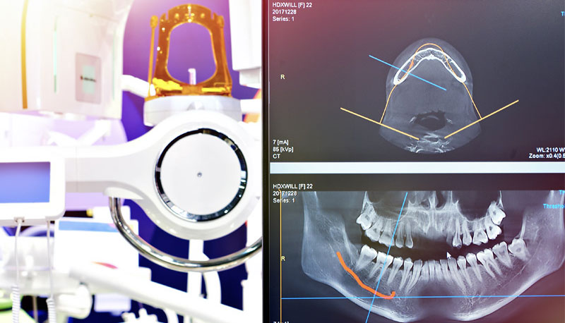 Dental Treatments in Fort Worth