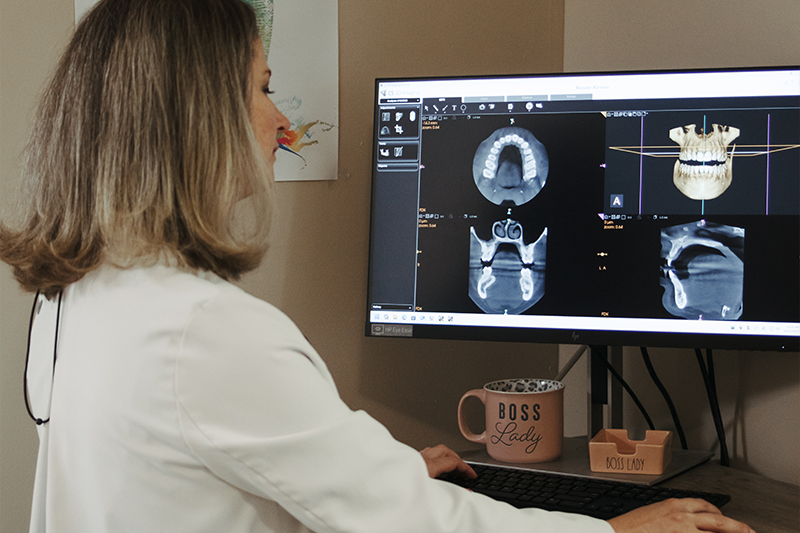 Intra-Oral Scanner in Eden