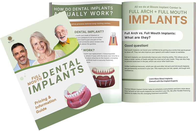 Bloom Implant Center Special Offer