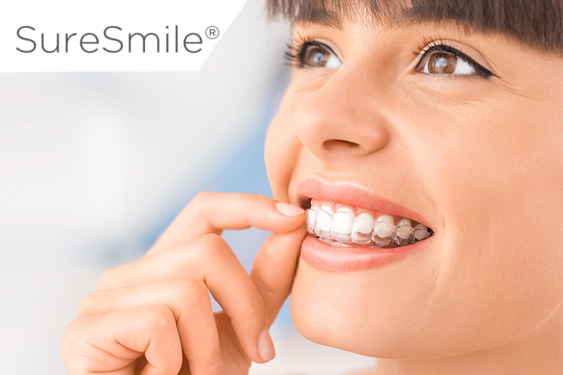 SureSmile® Clear Aligners in North Seattle