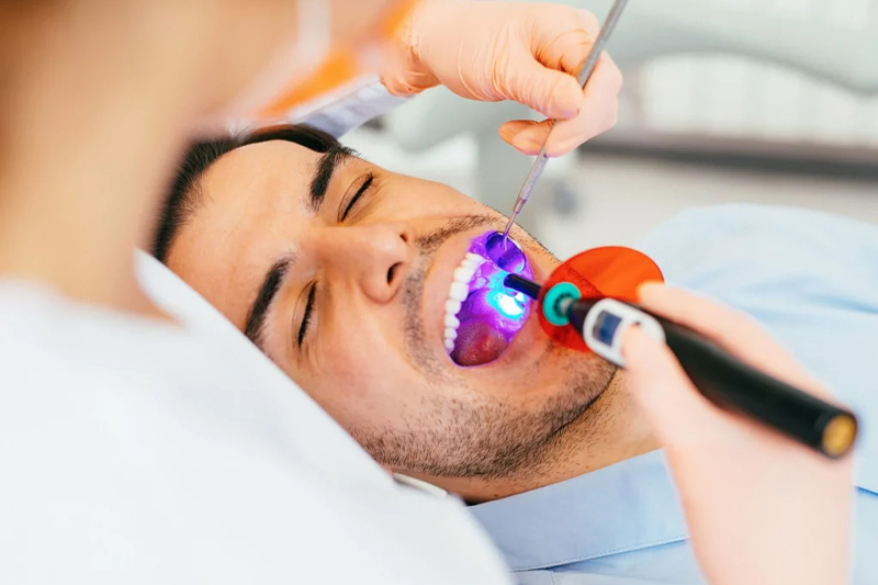 Dental Sealants in Lawrence Township