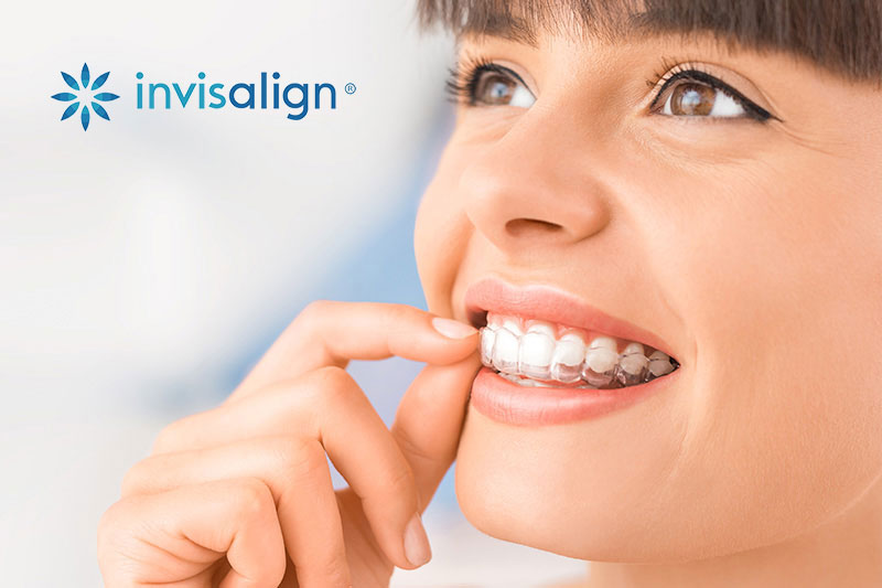 Quality Dental Treatments in Pembroke Pines