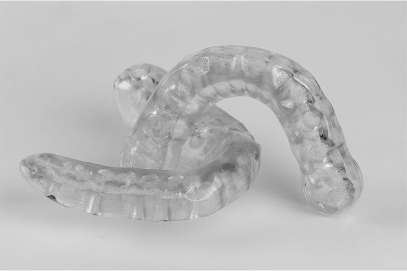 Mouthguards in Schererville