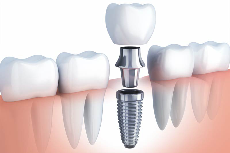 Dentist in Livonia