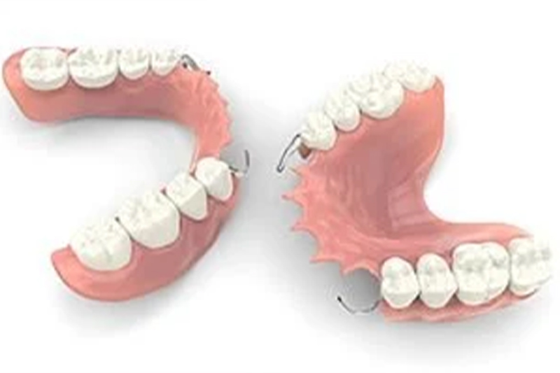 Removable Dentures in Clarkston