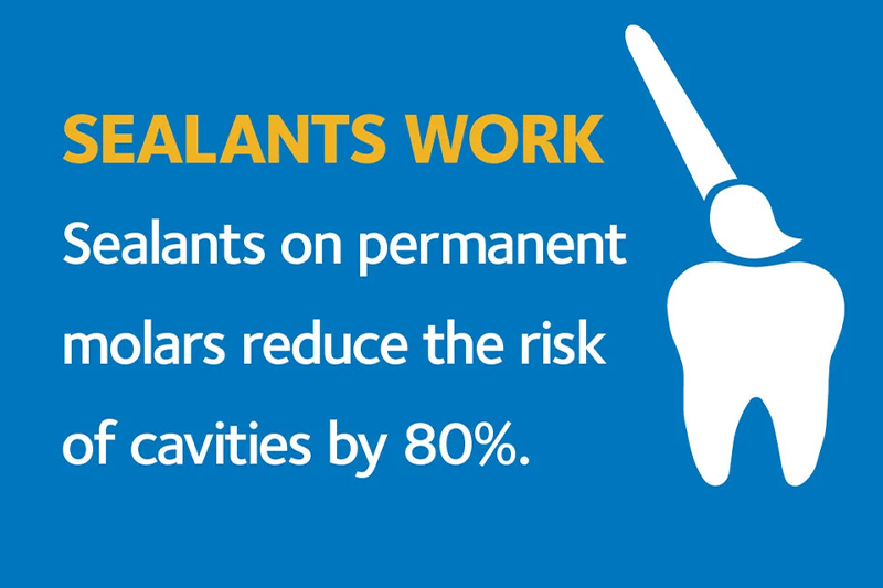 Sealants in Ridgeland