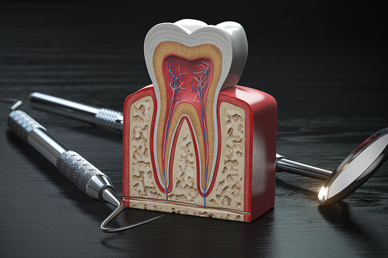 Root Canal Therapy in Aubrey