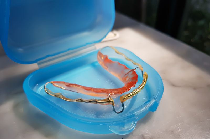 Retainers in Wesley Chapel