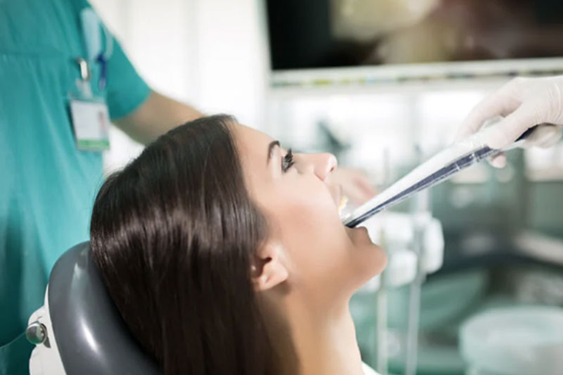 iTero Digital Scans in Palm Harbor