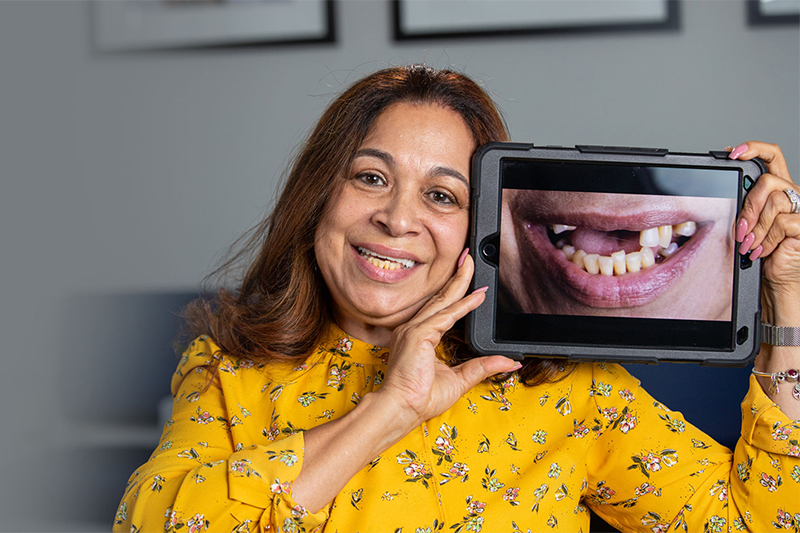 Dental Implants Surgery in Mt. Laurel