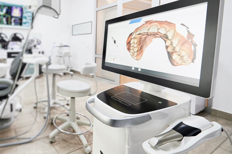 Intra-Oral Scanner in Hallandale Beach