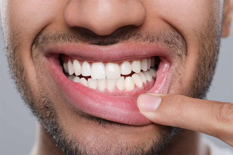 Tucson Periodontist Treatment in Tucson