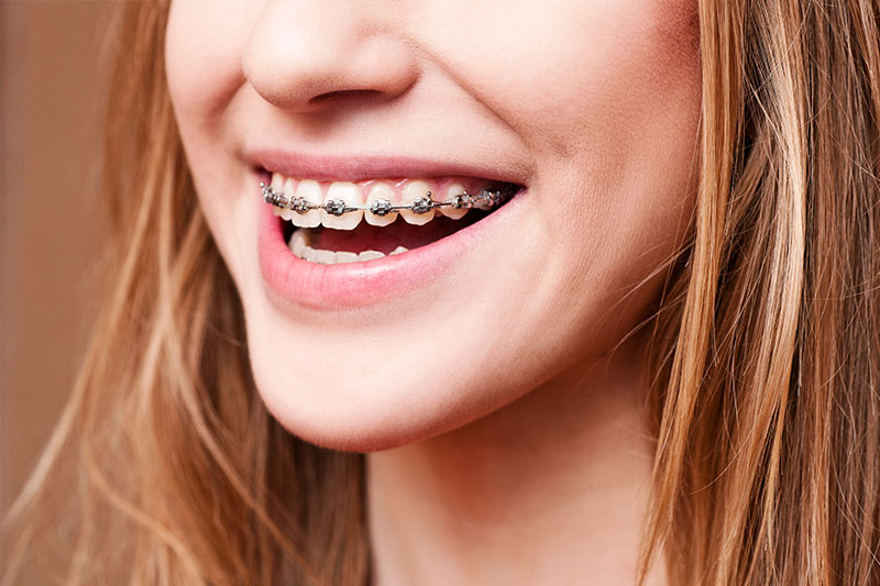 Orthodontics in New York