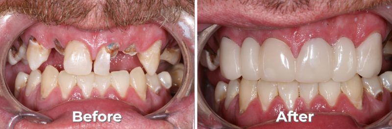 Snap on Smile in West Grove