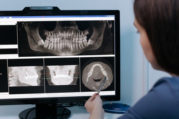 Digital Dental X-rays in West Grove