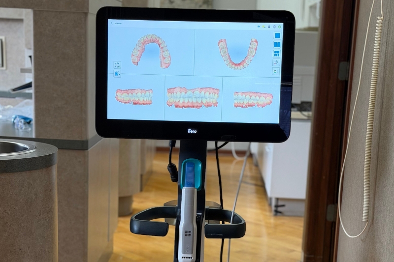 Intra-Oral Scanner in Chicago