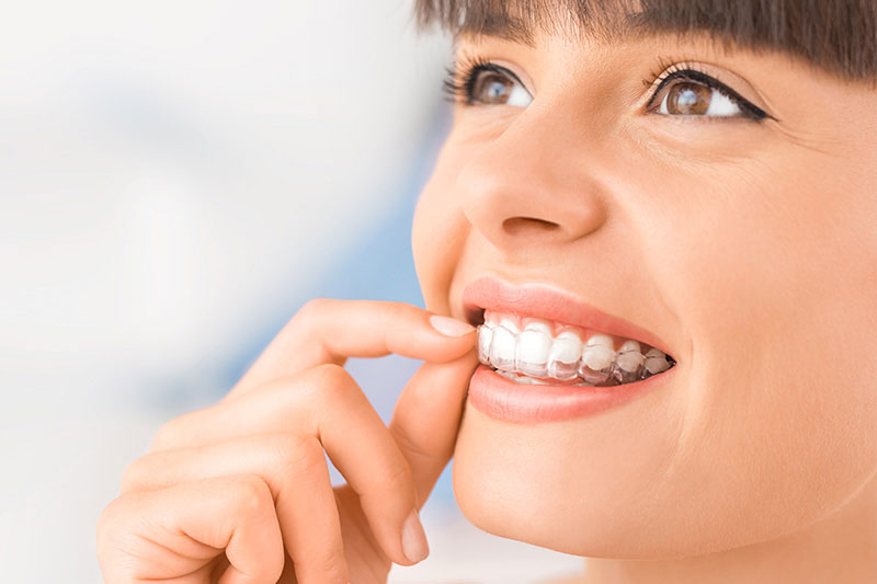 Invisalign® for Adults in Phoenix