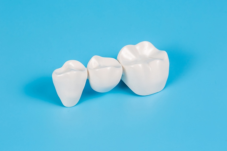 Dental Bridges in Littleton