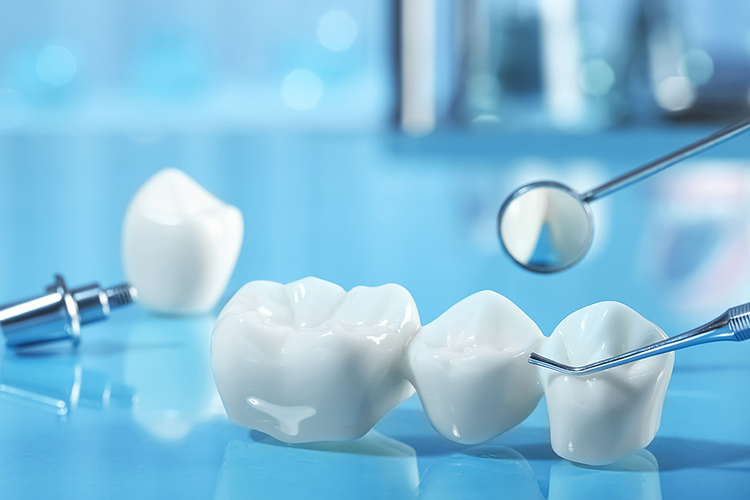 Dental Bridges in Littleton