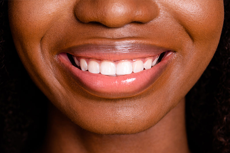 Smile Design Software in Saddlebrook