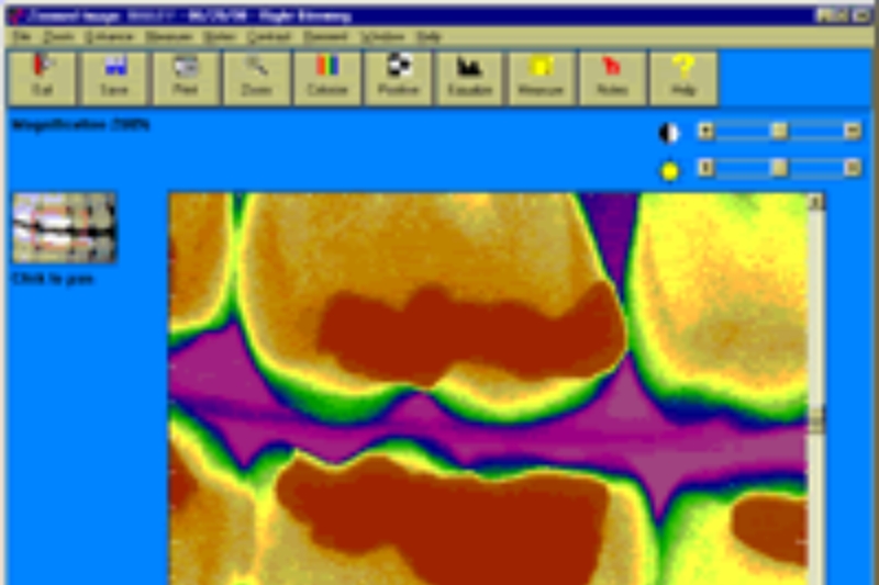 Computer Digital Radiography (CDR) in Massapequa