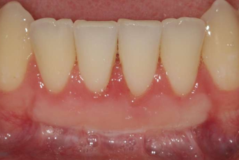 Before Afters