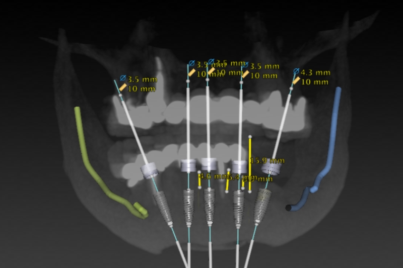 Cone Beam CT Imaging in Temple City