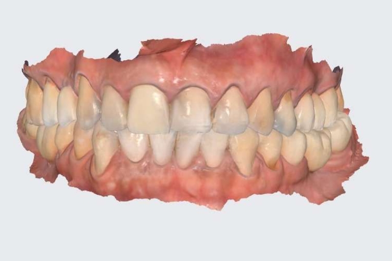 Intra-Oral Scanner in Temple City