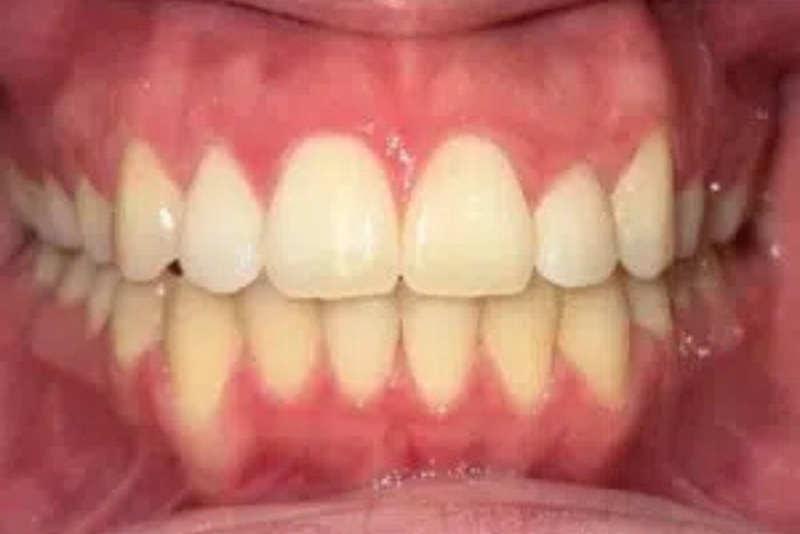 Cosmetic Dentistry - After