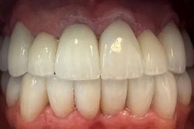 Cosmetic Dentistry - After