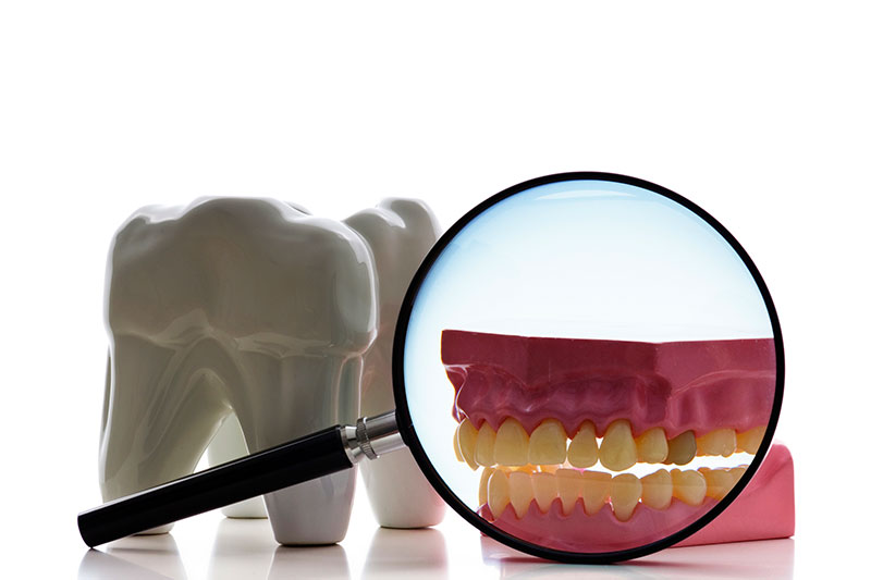 Root Canal in LaGrange Park