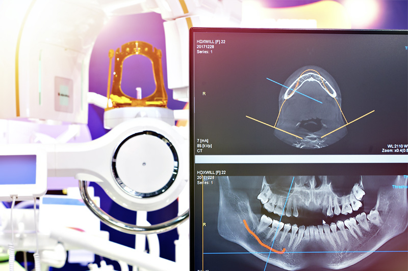 Digital X-Rays in Newton Falls
