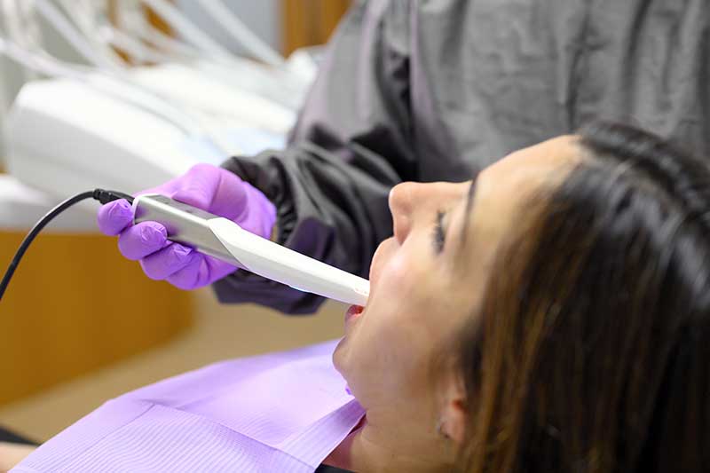 Intra Oral camera in 