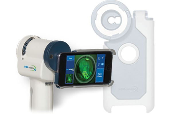 VELScope Digital Oral Cancer Detection in Fairfax