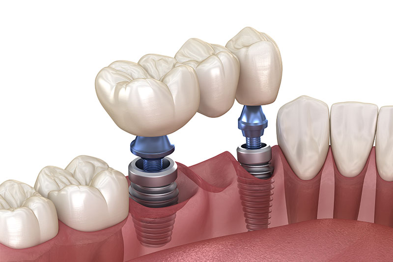Dentist in Manchester