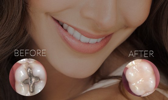 BioDental Healing Special Offer