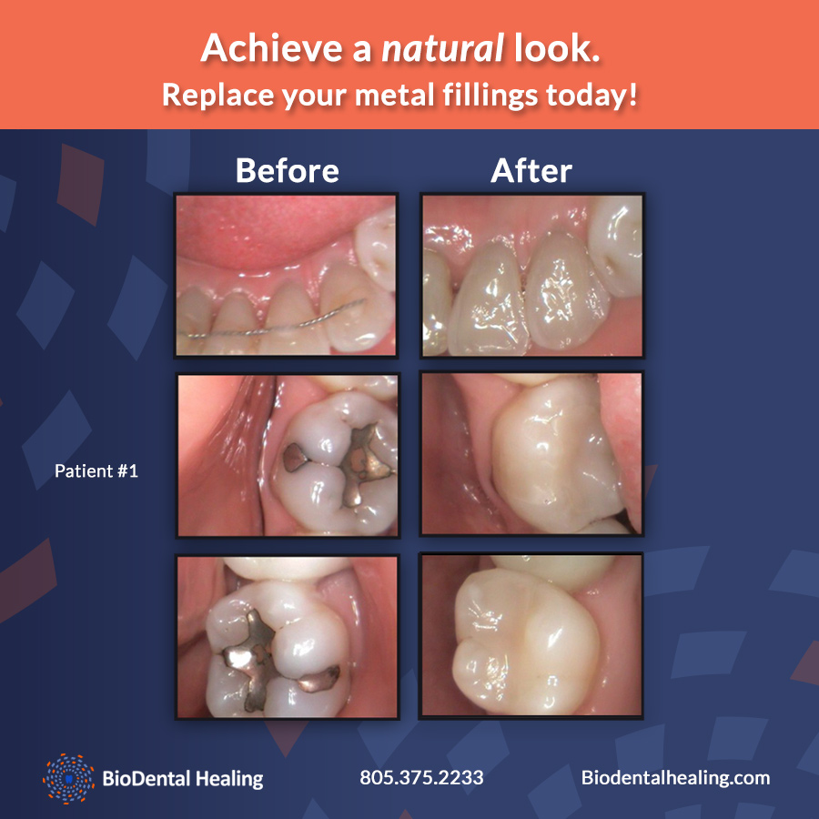 Cosmetic Dentistry in Newbury Park