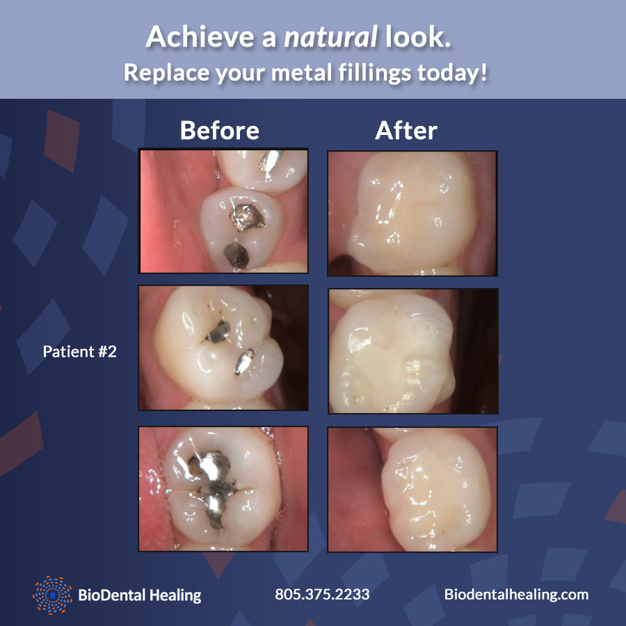 Cosmetic Dentistry in Newbury Park