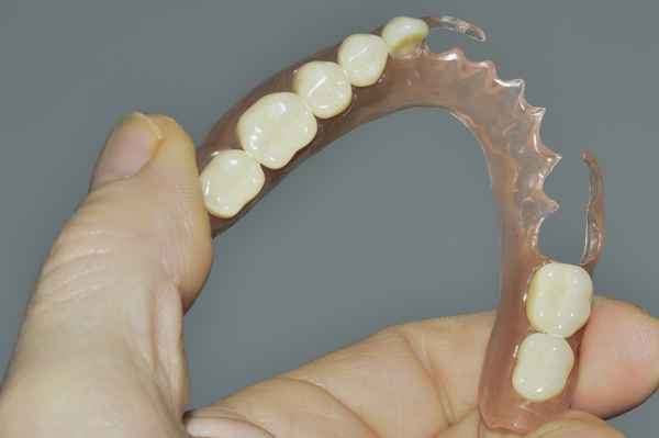 Metal-Free Removable Partial Dentures in Newbury Park