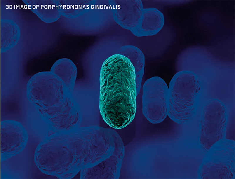 Guided Biofilm Therapy in Columbus