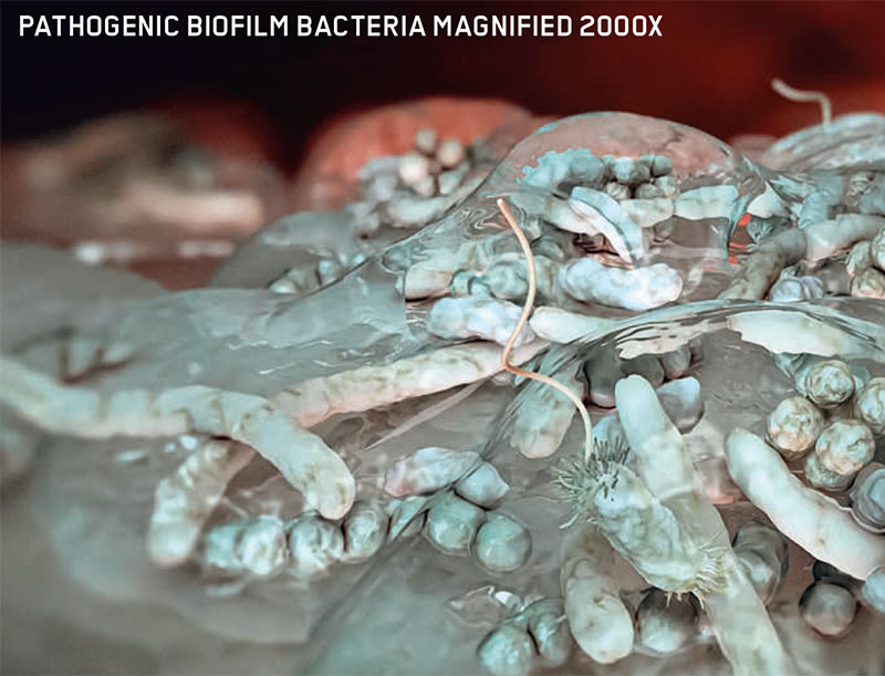 Guided Biofilm Therapy in Columbus