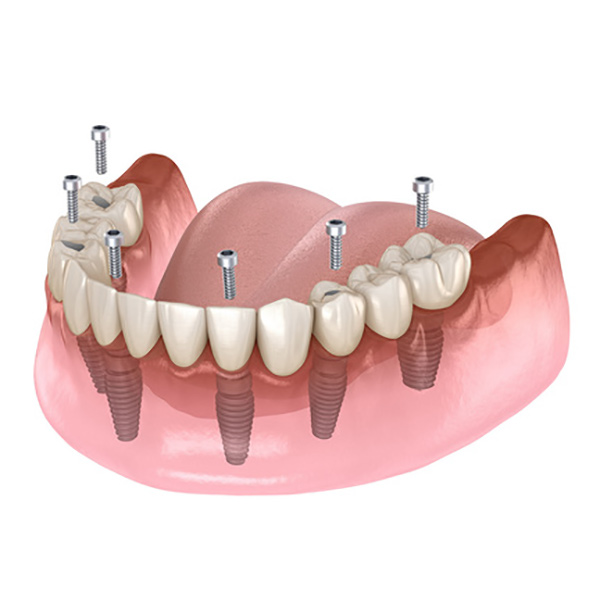 feature image